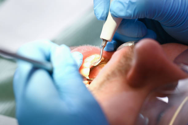 Best Emergency Dental Surgery in Geneseo, IL